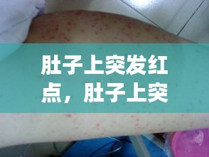 肚子上突发红点,肚子上突然长红点不痒不痛