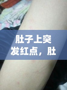 肚子上突发红点,肚子上突然长红点不痒不痛