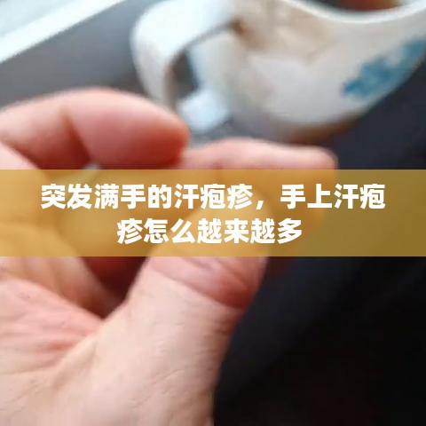 突发满手的汗疱疹,手上汗疱疹怎么越来越多